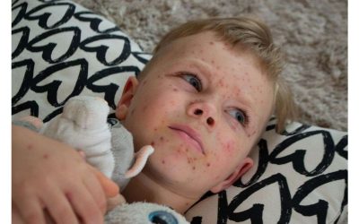 Unexpected Impacts of Mold Exposure on Children