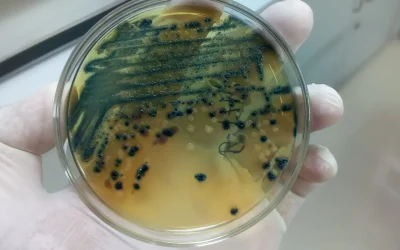 How Mycotoxin Testing Works for Human Safety and Wellness