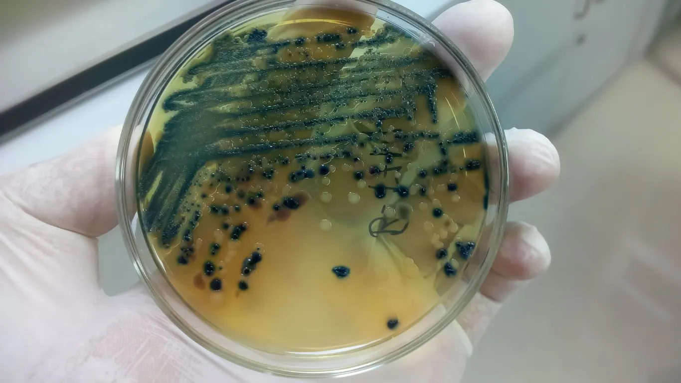 gloved-hand-technician-scientist-holding-petri-dish-background-microbiology-lab_1366